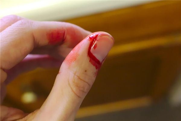 梦见手被切断是什么意思 梦见手被切断是什么意思