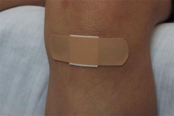 梦见伤口是什么意思 梦见伤口是什么意思